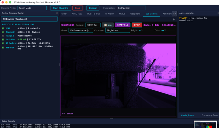 SLS camera — UV fluorescence vision